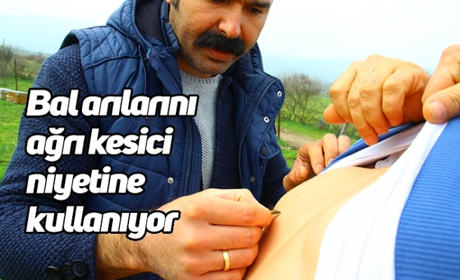 Bal arılarını ağrı kesici niyetine kullanıyor