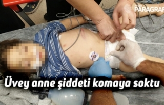 Üvey anne şiddeti komaya soktu
